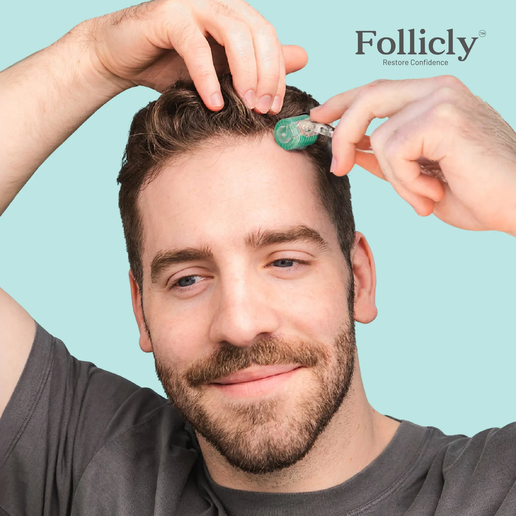 Follicly™ Derma Roller 3-Pack – 192 Authentic Titanium Microneedles (Value Bundle)